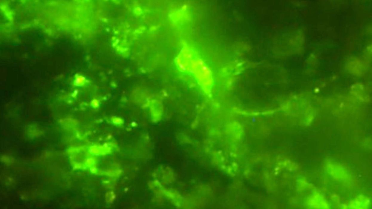 Miraculous microbe could protect humans from the most dangerous forces on Earth