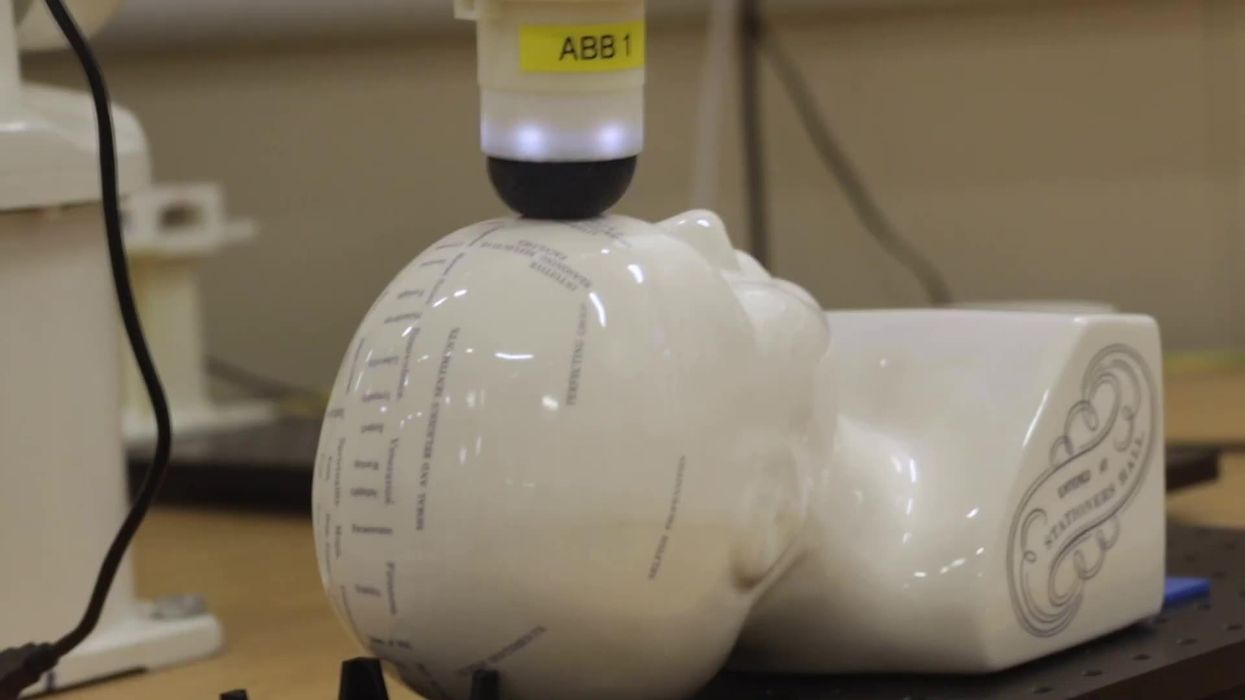 A man 3D printed the skull of his two month-old baby