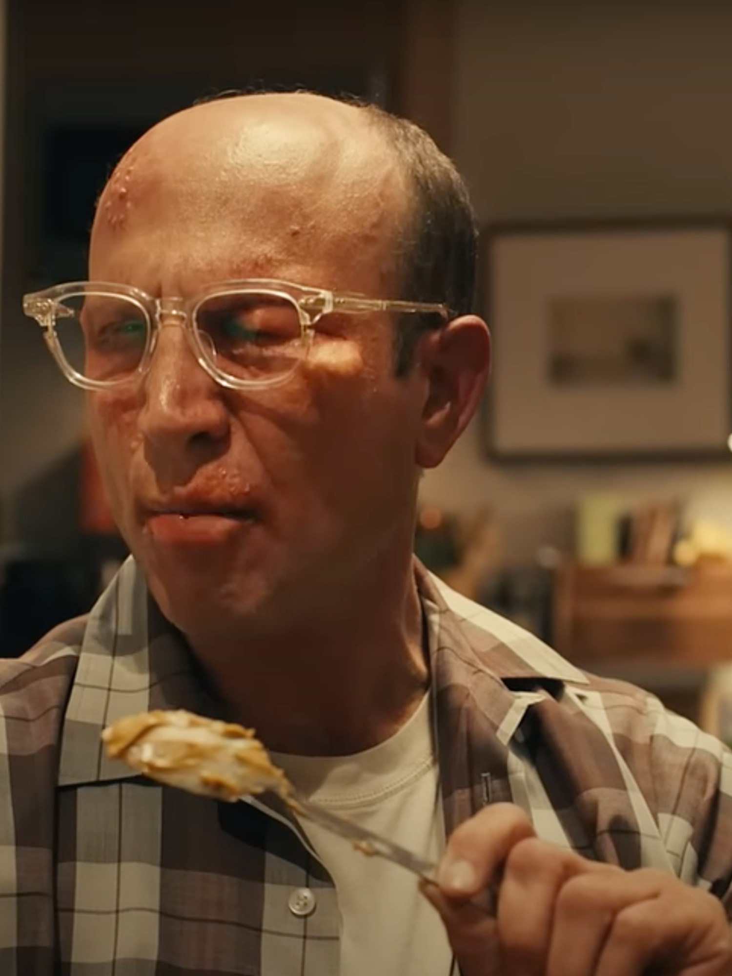 A man with glasses and short hair at the back of his head holds a jar of peanut butter in his right hand. His left eye is swollen shut and his lips are puffy, as if he is having an allergic reaction.