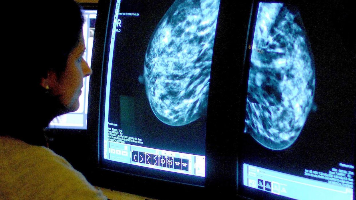 <p>A medical staffer checking a mammogram</p>