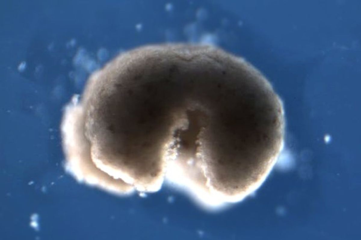 A so-called 'biobot'