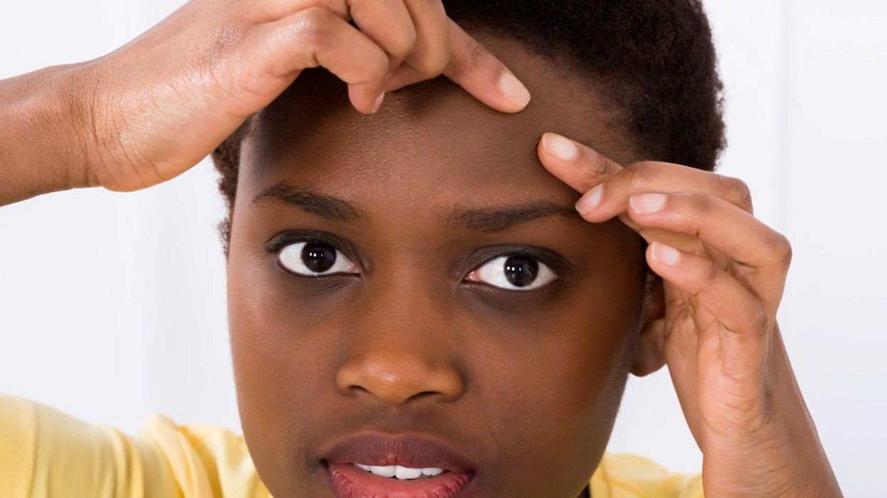 What the location of your spots says about your health