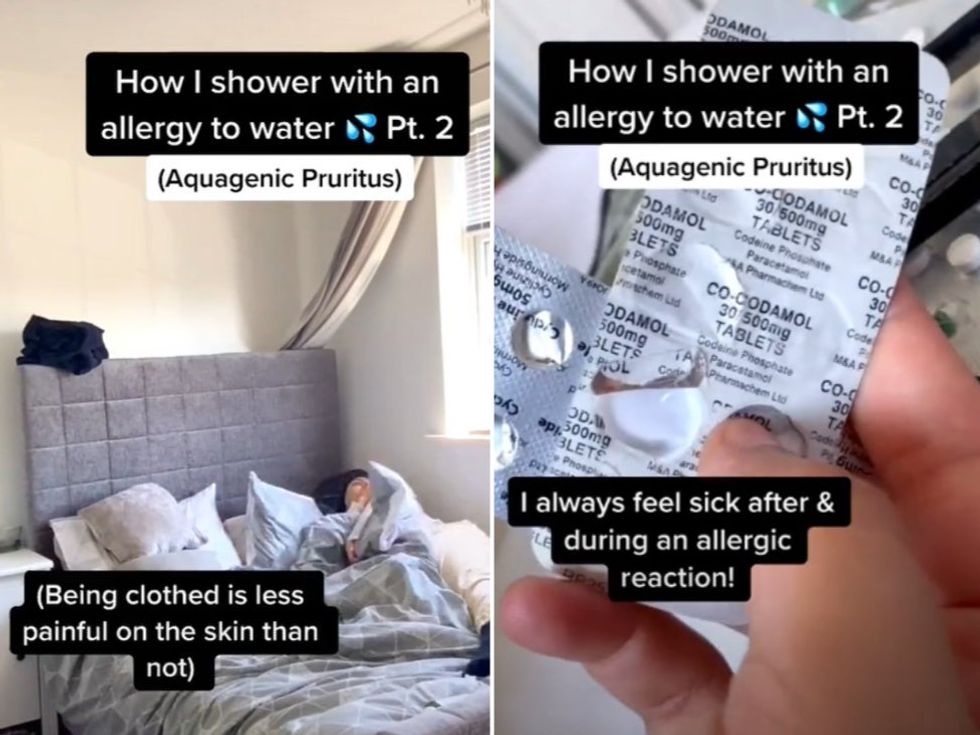 Woman who is allergic to water explains how she bathes in viral TikTok
