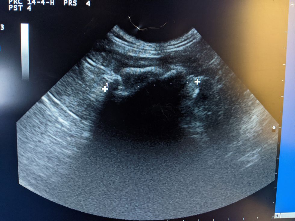 An ultrasound shows a face mask in Toffee the dog's stomach