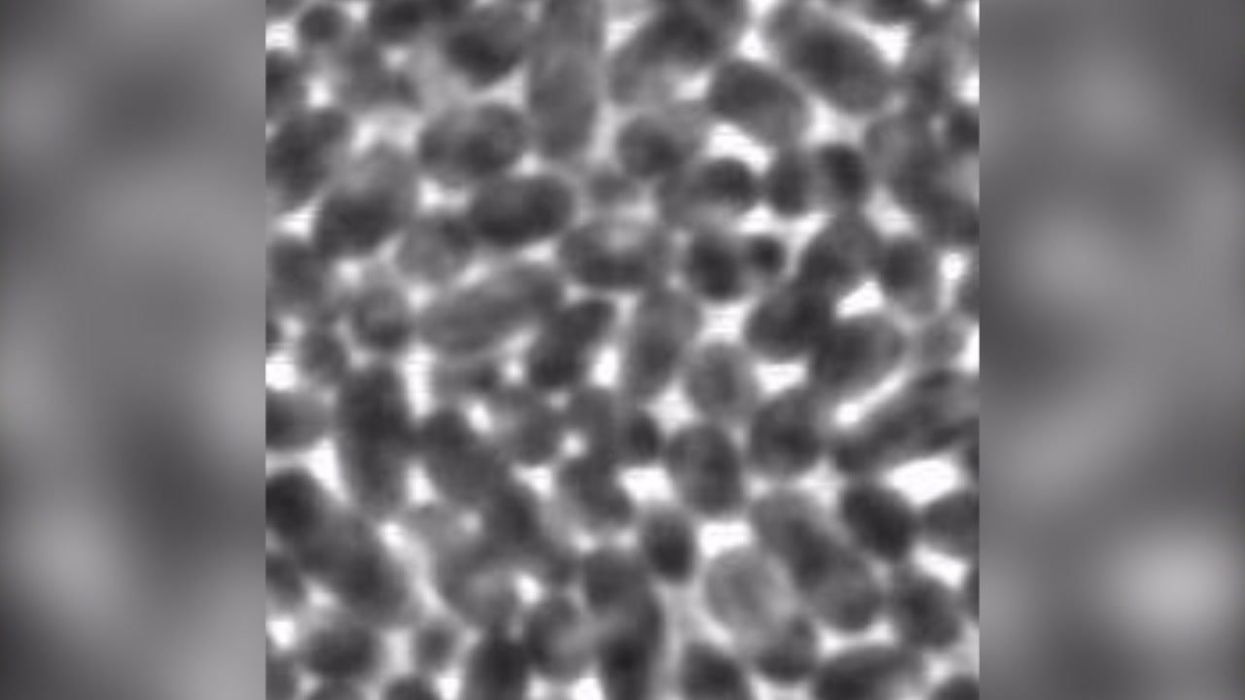 Sushi could secretly be spreading antibiotic resistance