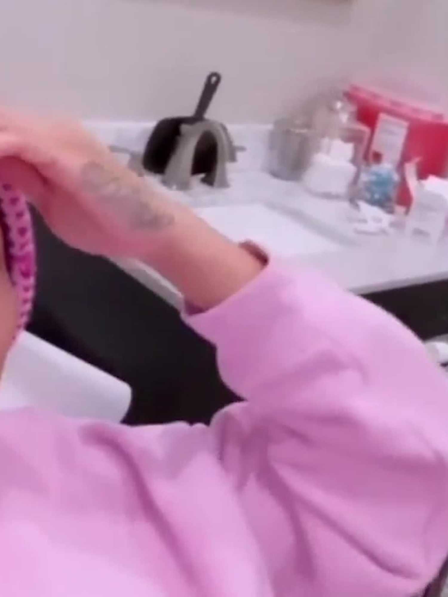 Blac Chyna shows off face transformation having fillers dissolved