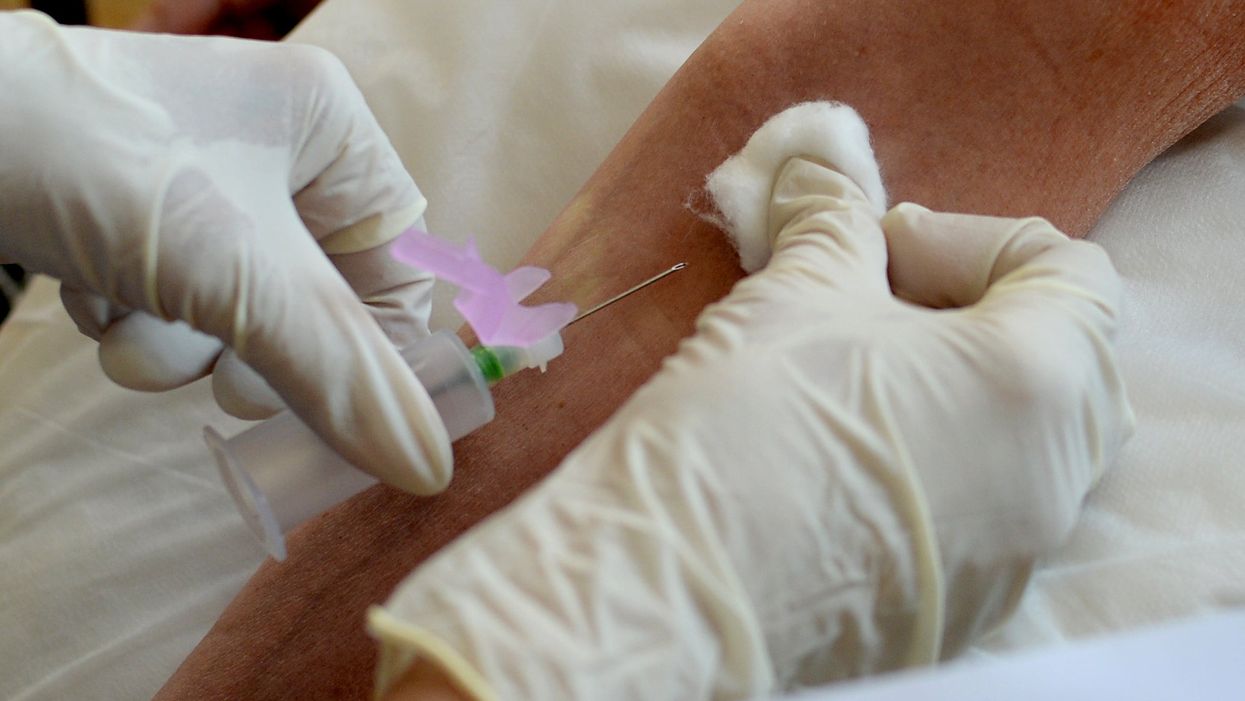 <p>Blood test</p>