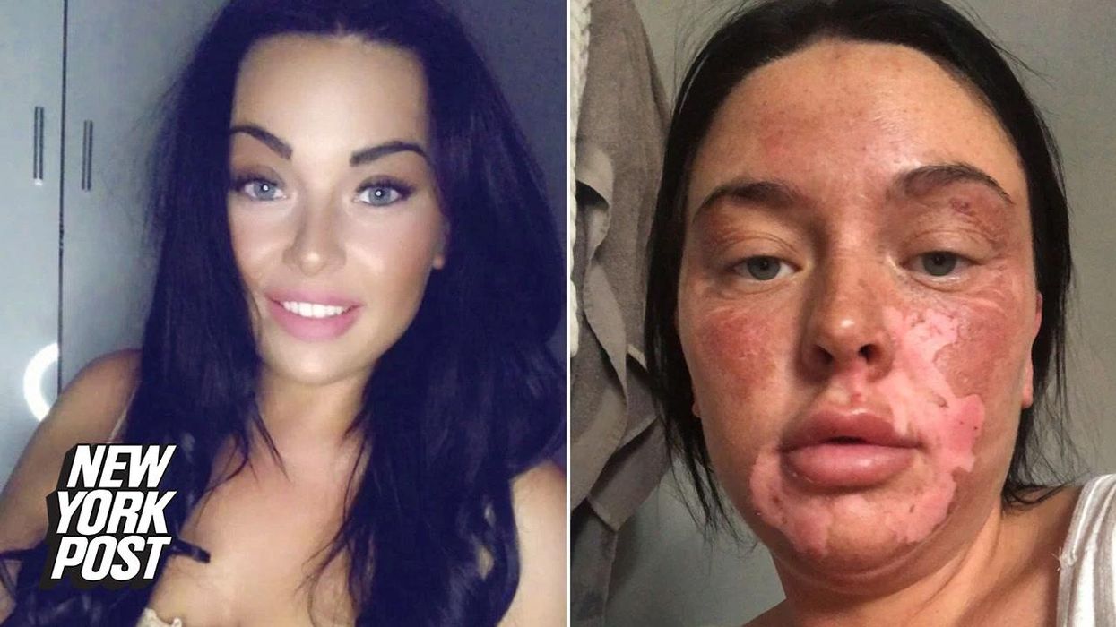 Man left with 'whistling scrotum' after botched surgery