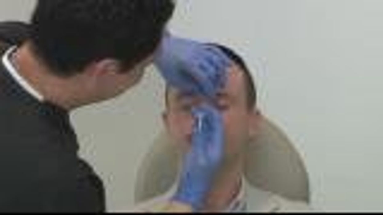 Men are having more secret Botox treatments than ever before, new research finds