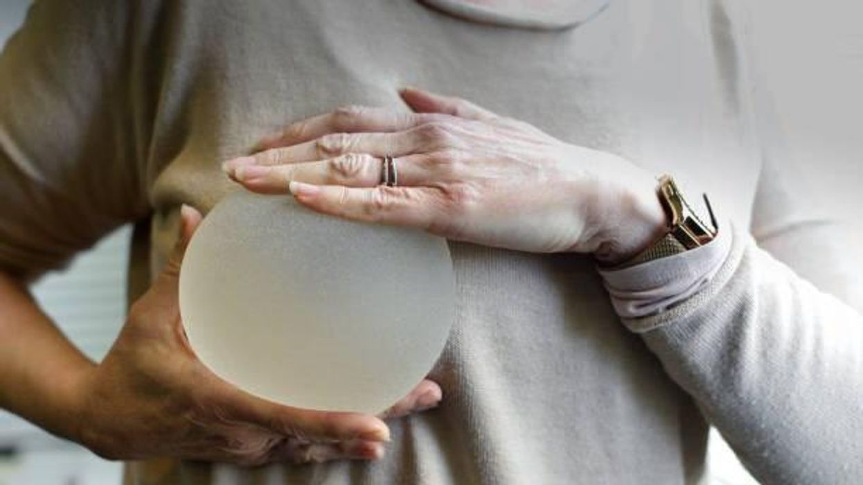 Woman finds mould in breast implant after suffering unidentified illness for 10 years