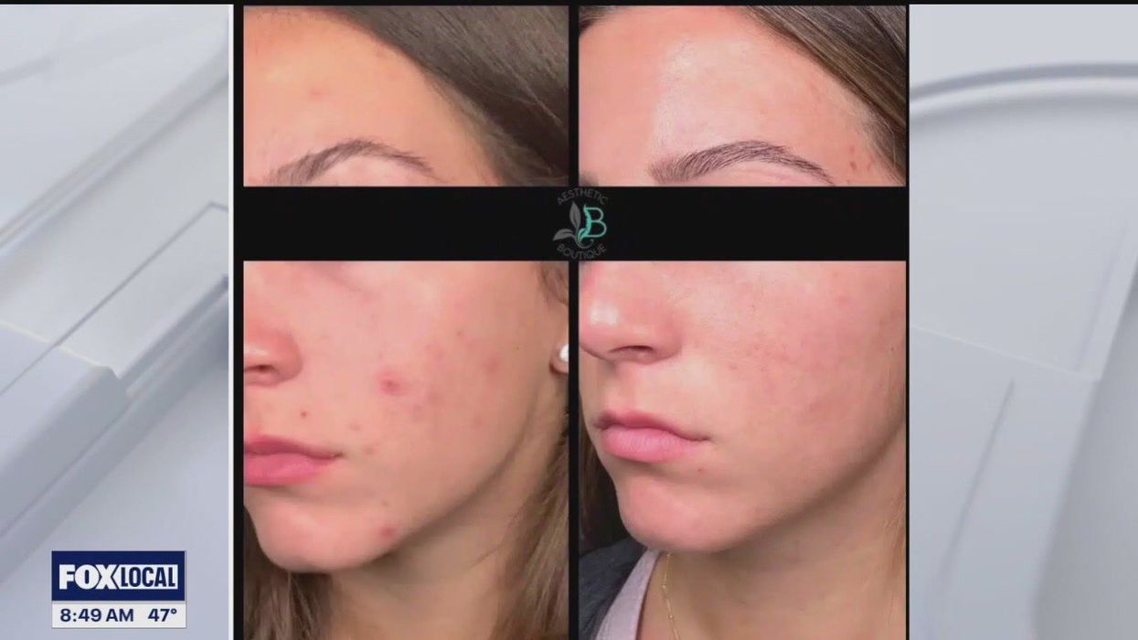 'Crisis point' in young girls over social media skincare trends, dermatologist warns