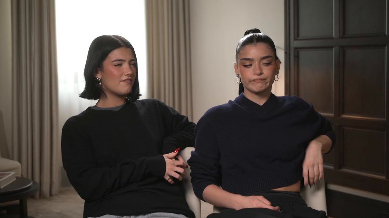 Dixie D'Amelio displays her black eye after drunken incident