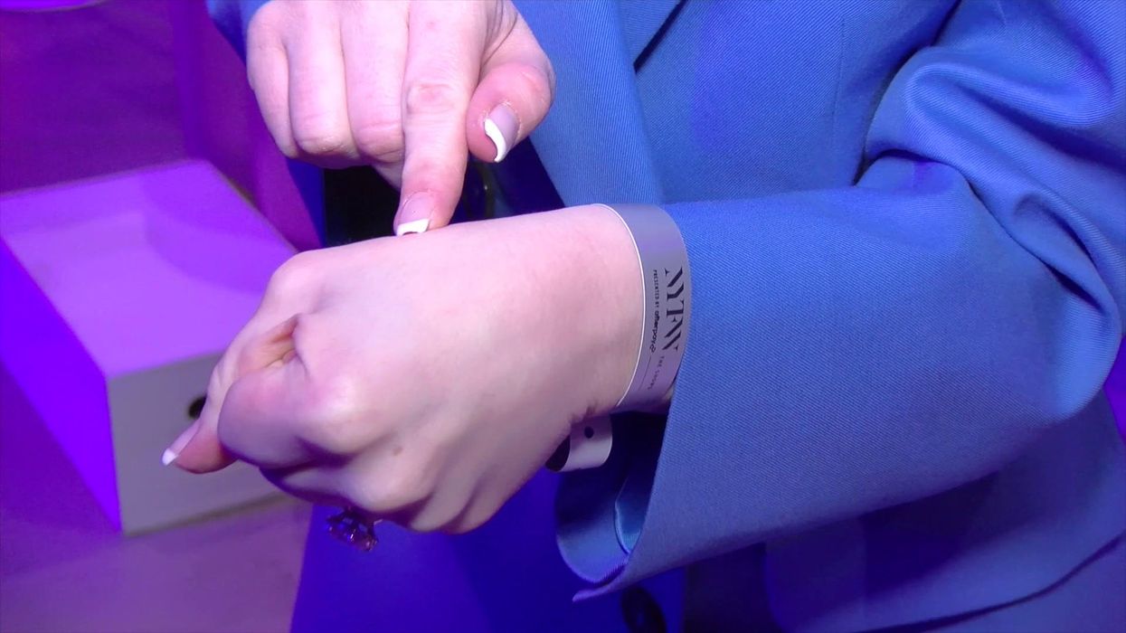 This woman's silicone implants in her thumbs are causing people to gag