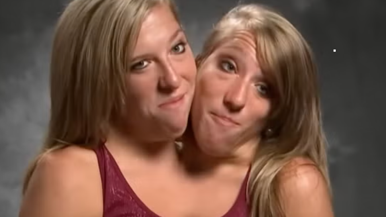 Conjoined twins Abby and Brittany Hensel hit back at hate after wedding revelation