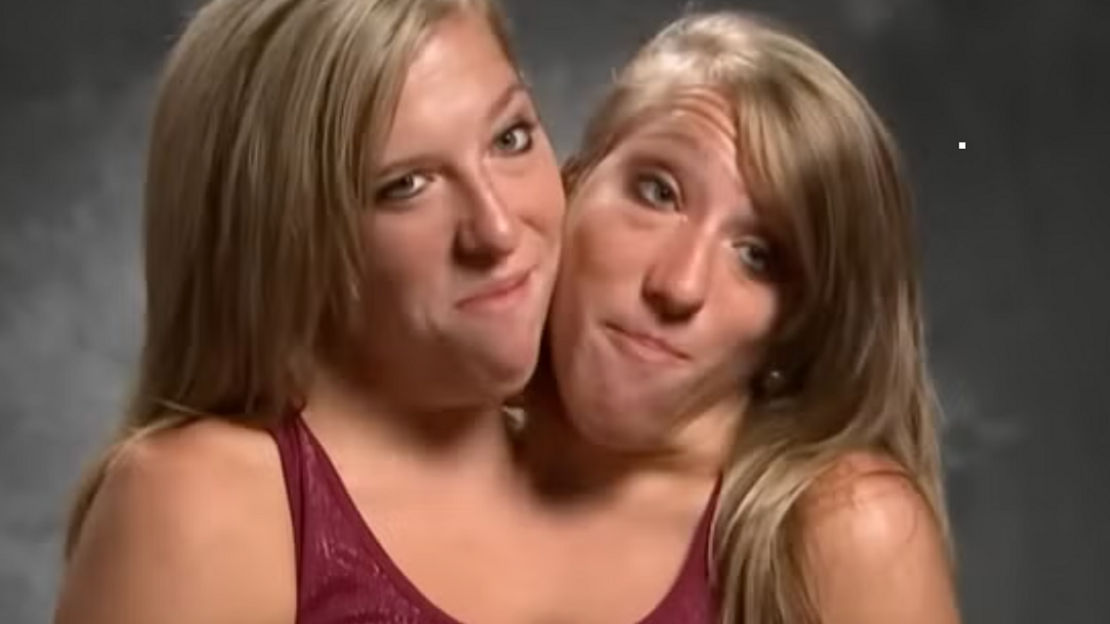 Conjoined twins Abby and Brittany Hensel hit back at hate after wedding revelation