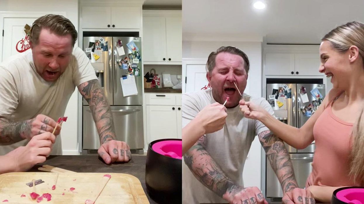 Man begins to grow thick black 'hair' on his tongue caused by no-solid diet