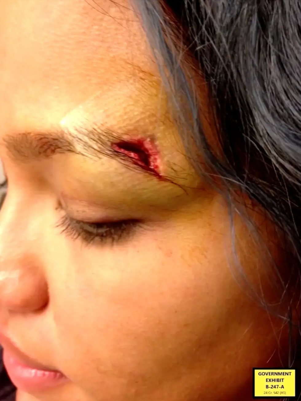 Department of Justice shared an image of Casandra Ventura's injuries