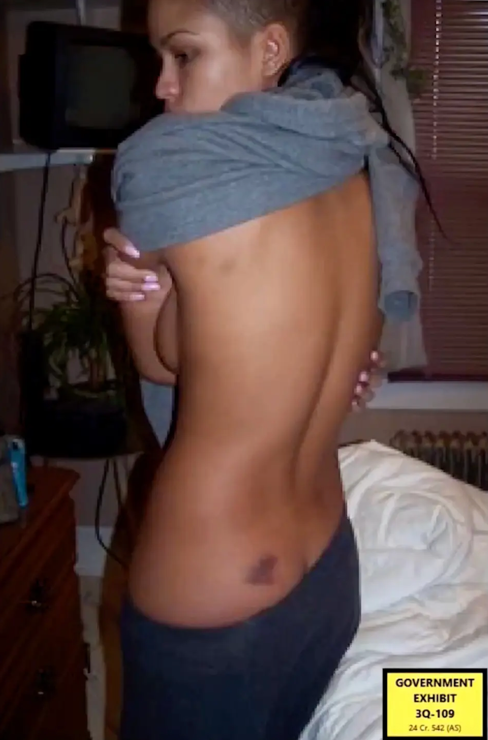 Department of Justice shared an image of Casandra Ventura's injuries