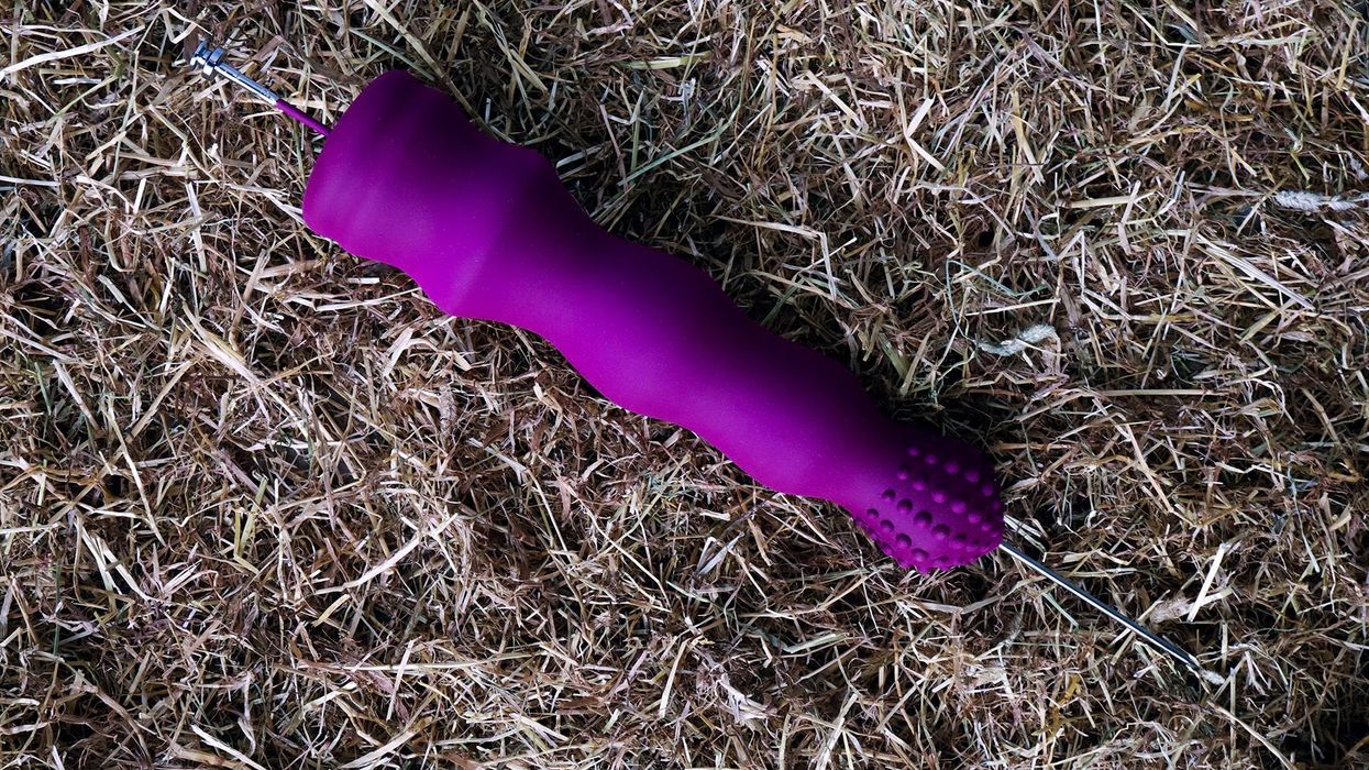 Woman has to have surgery after sex toy gets stuck inside her