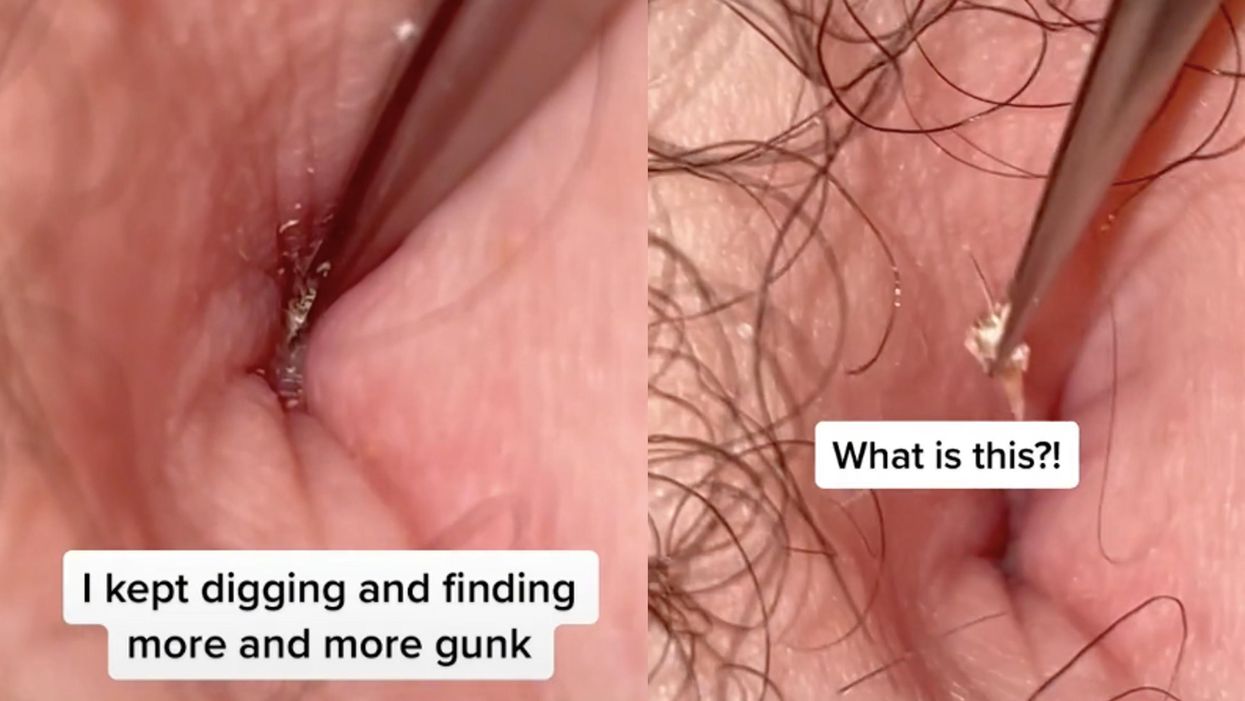 Doctor reveals disgusting reason you should always wash your belly button