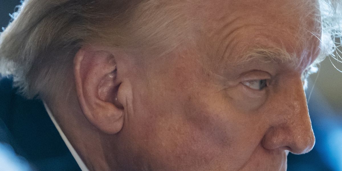 Photos of Trump without ear bandage have everyone pointing out lack of ...