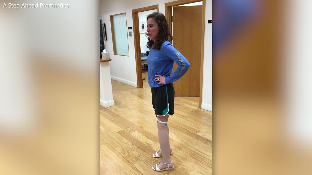 Triple amputee is now dancing in Ecuador's biggest reality TV contest