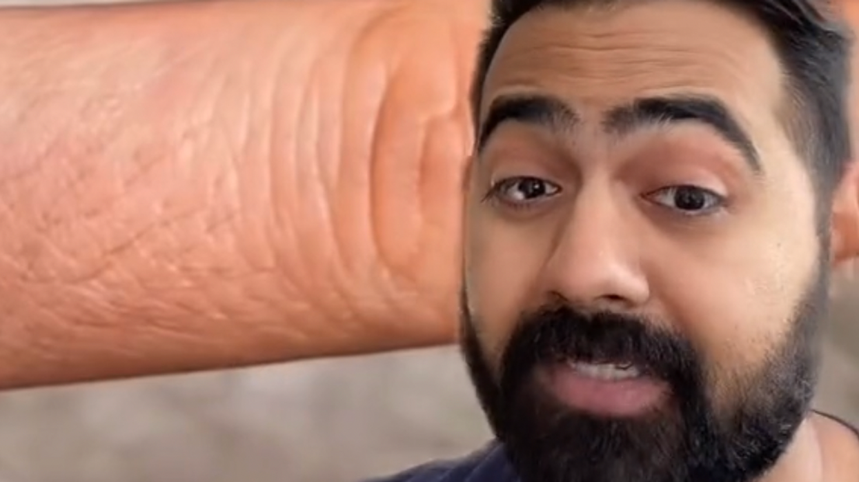 The TikTok ‘skin pinch’ test can tell if you’re dehydrated in seconds