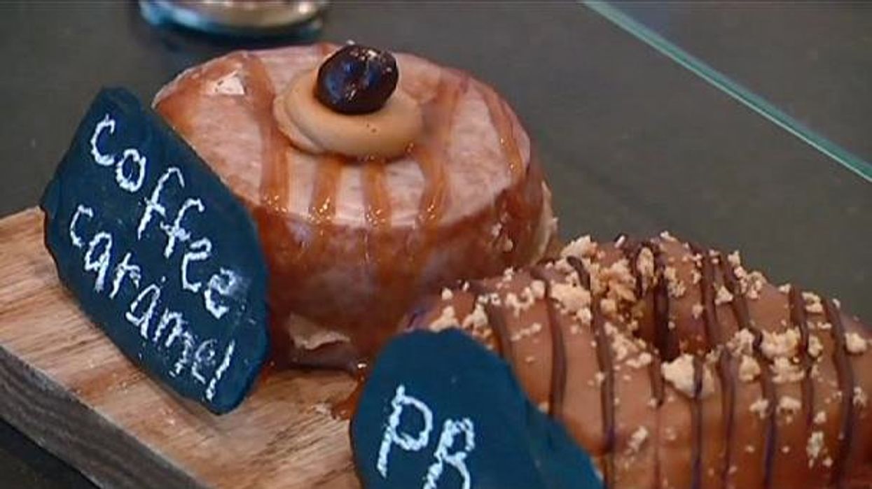 Dentist reveals key signs you're eating too much sugar