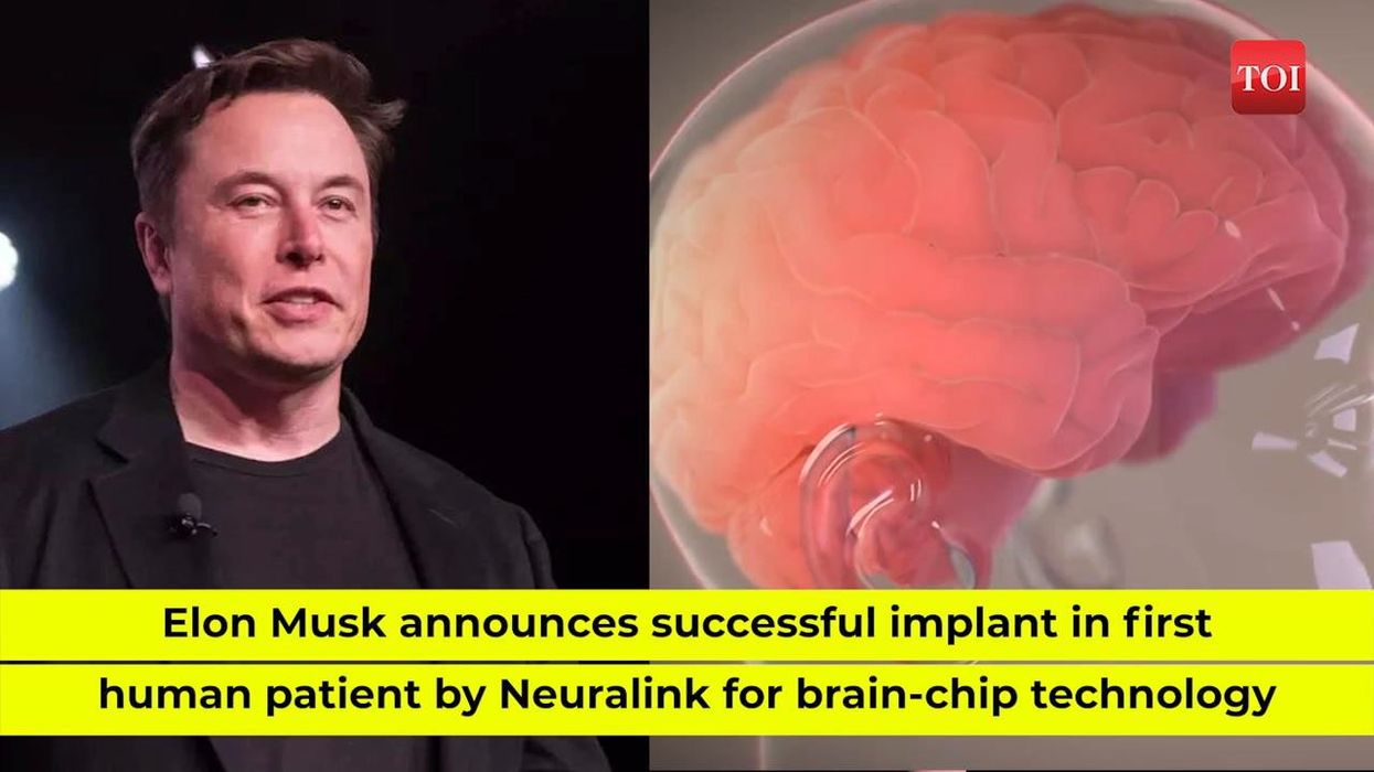Elon Musk's brain implant announcement compared to a 'sci-fi horror game'