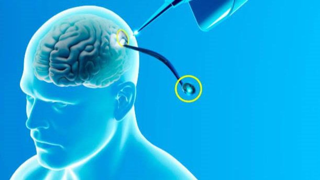 Elon Musk's Neuralink is 'under federal investigation' over animal welfare breaches