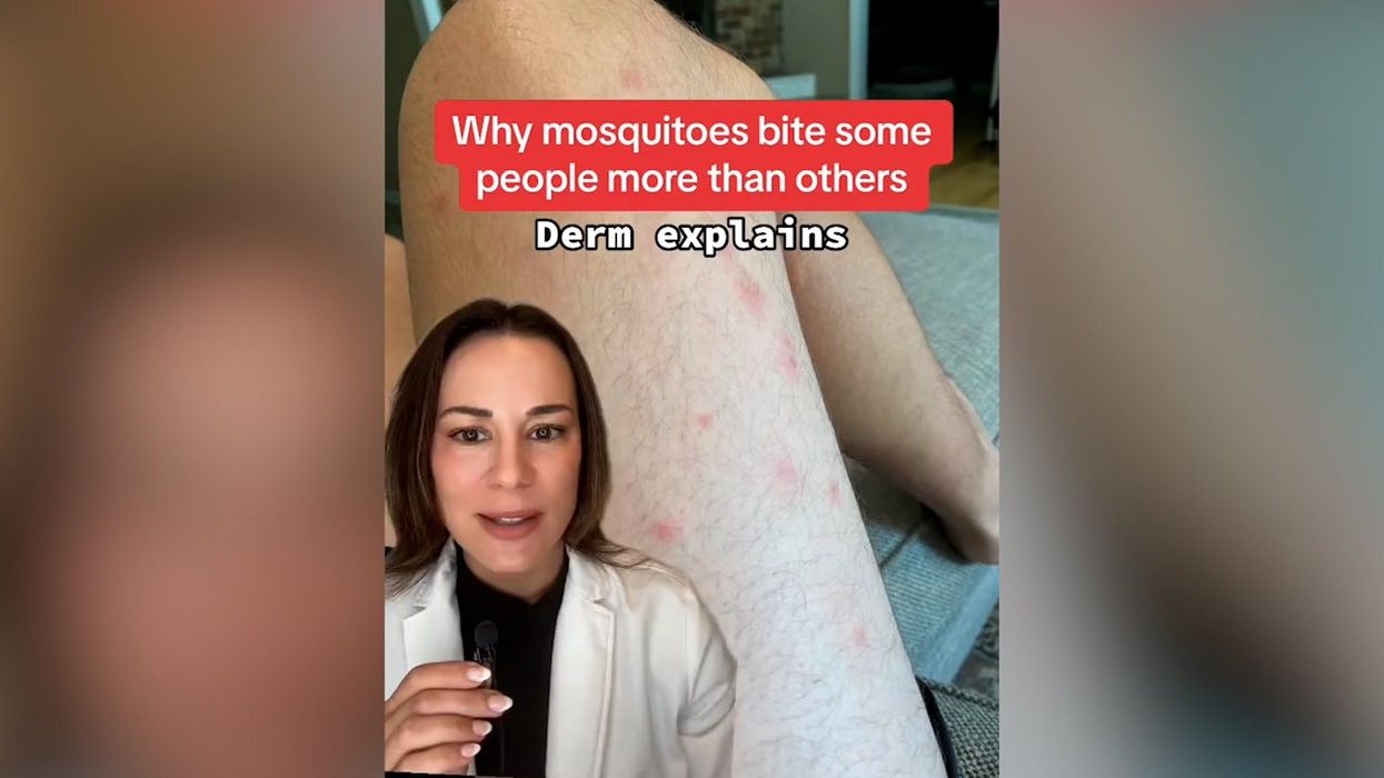 Expert reveals real reason why some people always get mosquito bites