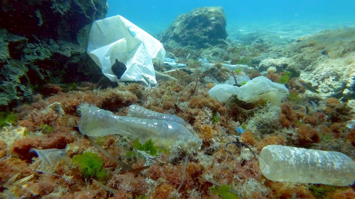 You may already have microplastics in your brain