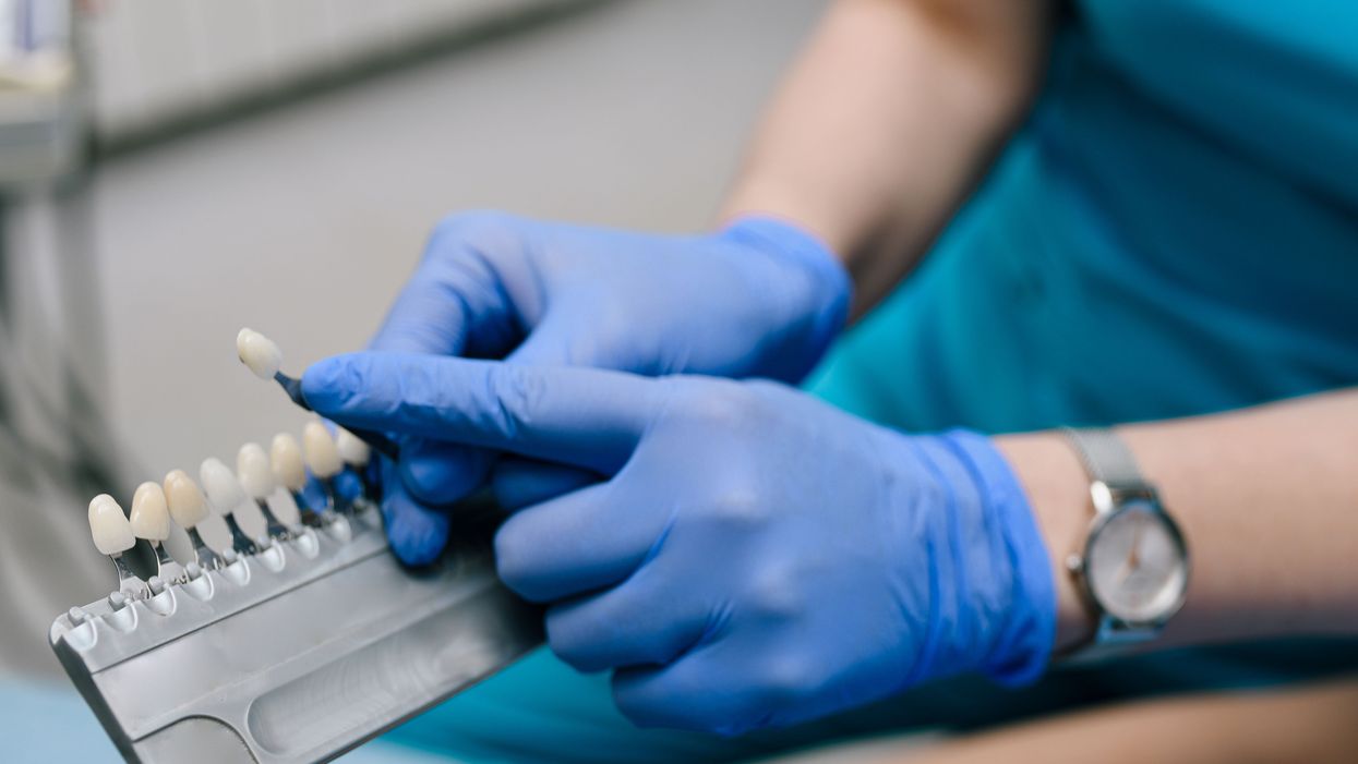 <p>Filing down the teeth to pegs is not a standard preparation for veneers</p>