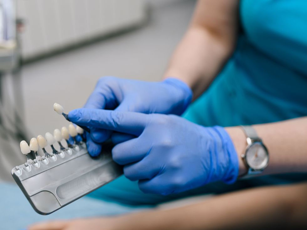 <p>Filing down the teeth to pegs is not a standard preparation for veneers</p>
