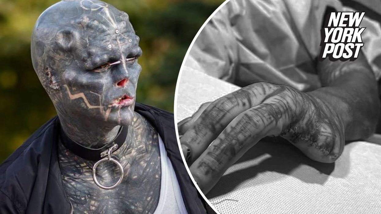 'Black alien' has flesh carved out of his head to spell his name