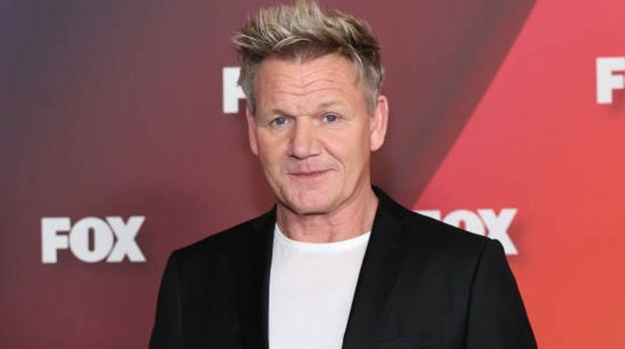 Gordon Ramsay shows brutal injuries after 'really bad' cycling accident