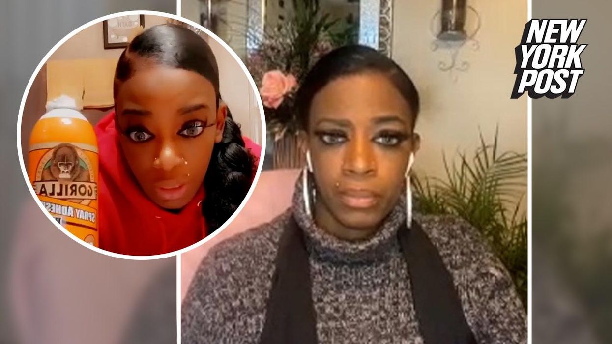 Bride called 'crazy' for supergluing her ears to her head