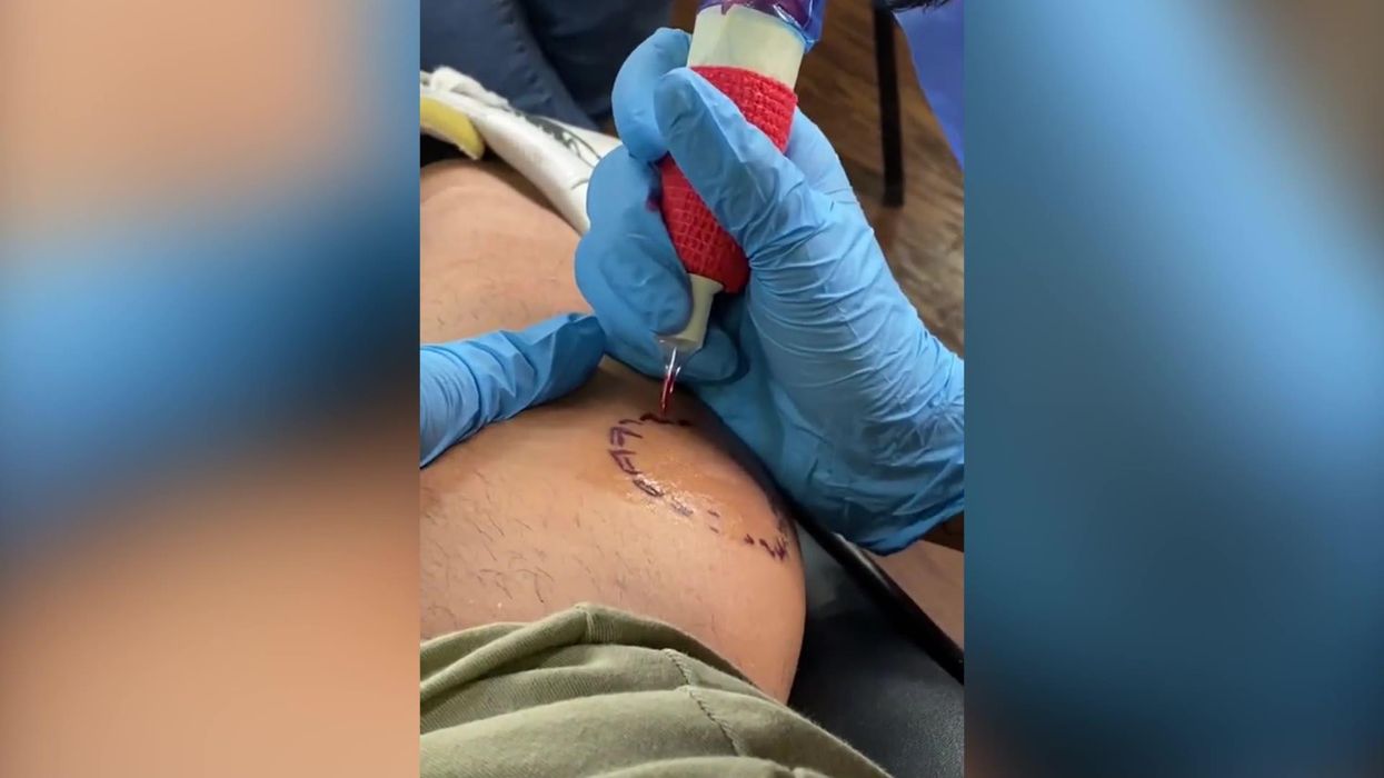 Guy gets mum's bite mark tattooed on him in unusual inking