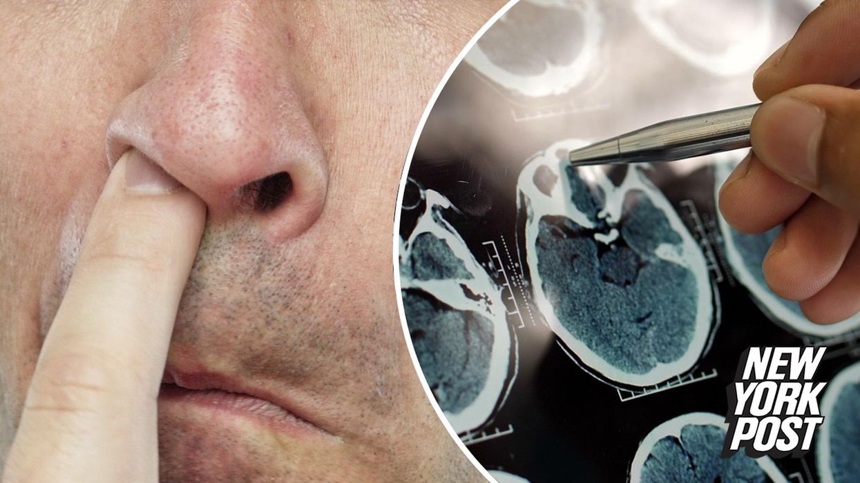 Why picking your nose could increase risk of Alzheimer's