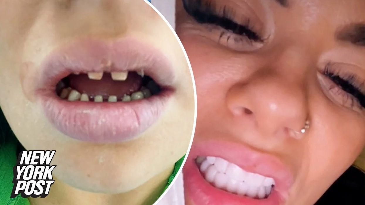 Woman in tears after veneers 'ruined her life'
