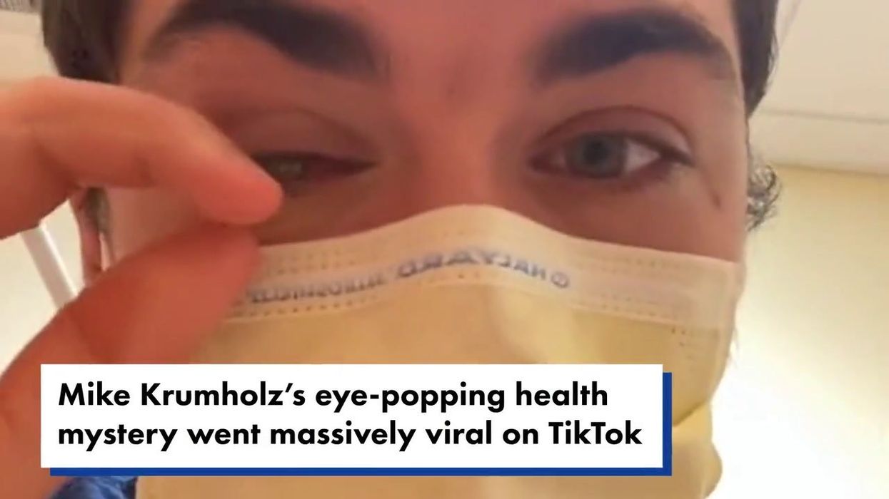 Man contracts flesh-eating parasite and goes blind in one eye after taking a quick nap