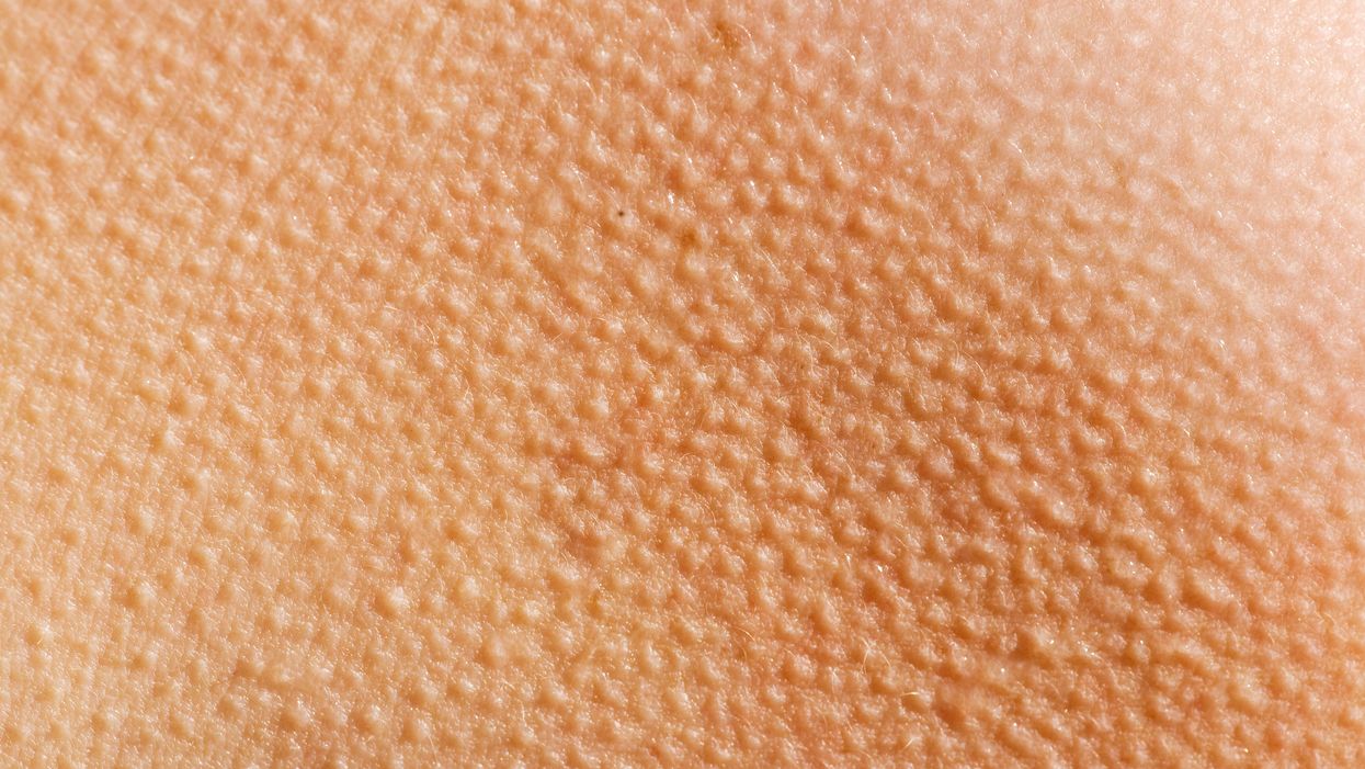 If you can give yourself goosebumps, your brain might be special