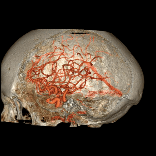 These gifs of the human body are slightly gory, slightly wonderful