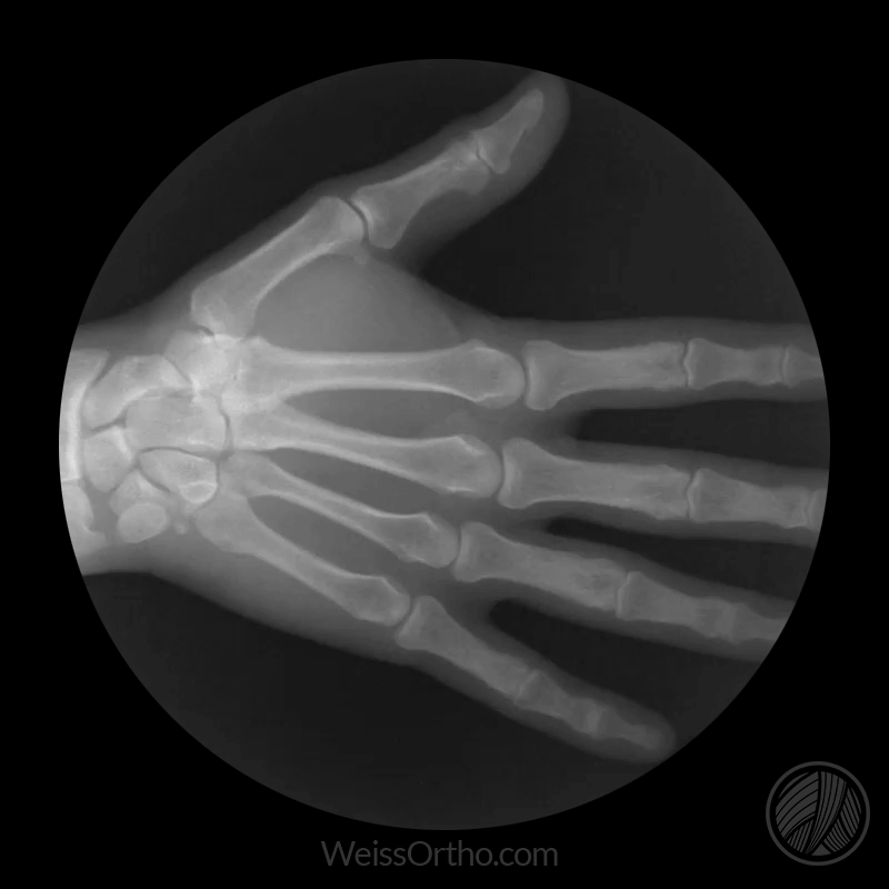 These X-ray gifs are easily the coolest thing you will see all day