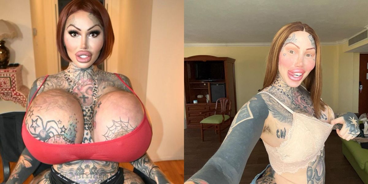 Surgery-addicted social media star with 10kg implants risks
