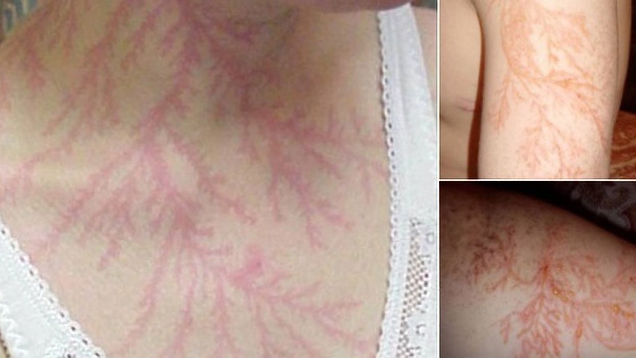 Incredible photos show what can happen to your body if you're
