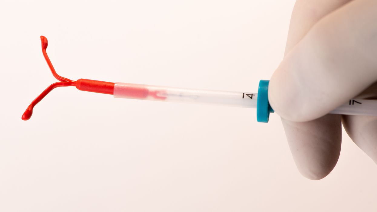 People are removing their IUDs at home and sharing DIY videos on how to do it