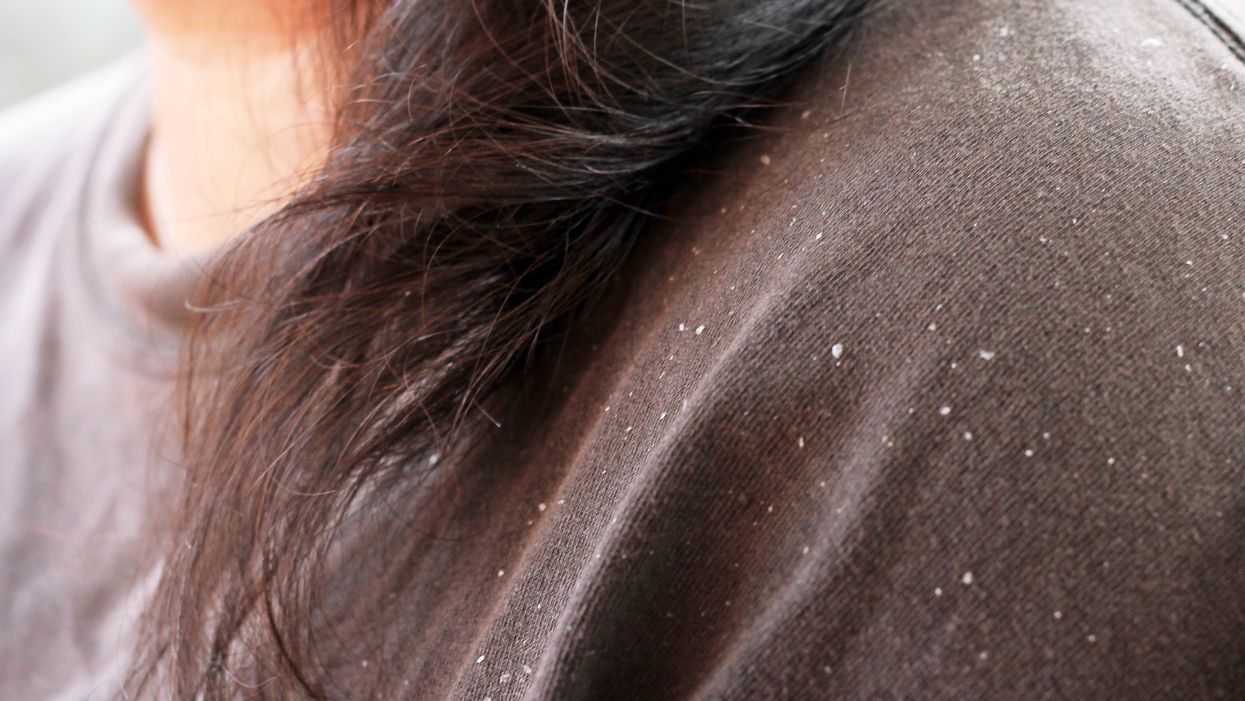 10 best dandruff shampoos to keep your shoulders flake-free