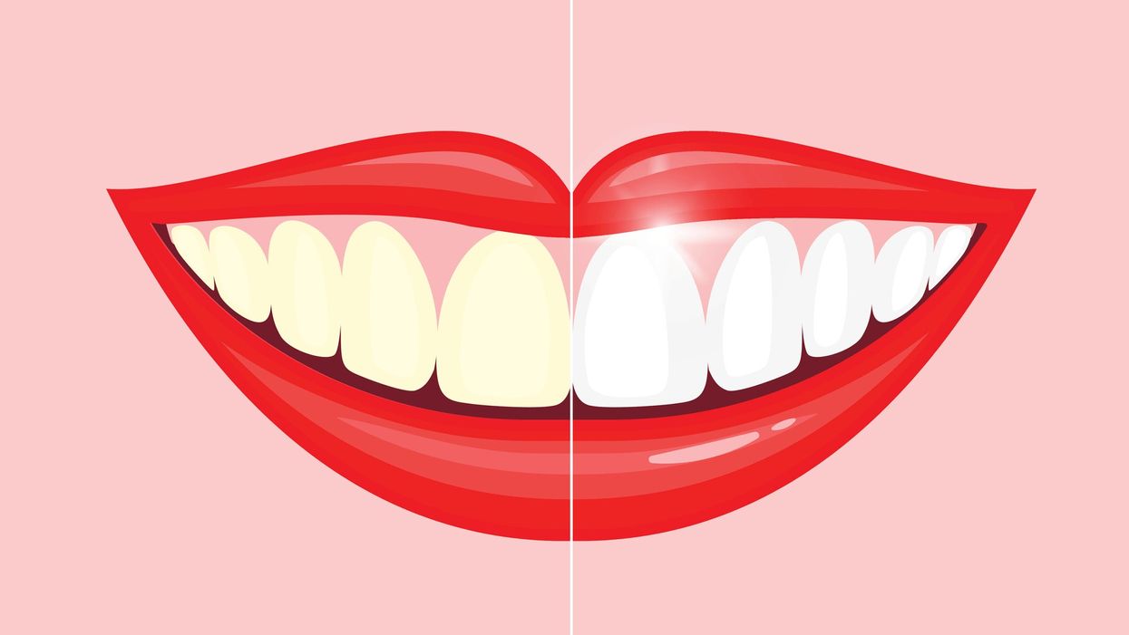 3 best at-home teeth whitening systems according to oral health specialists