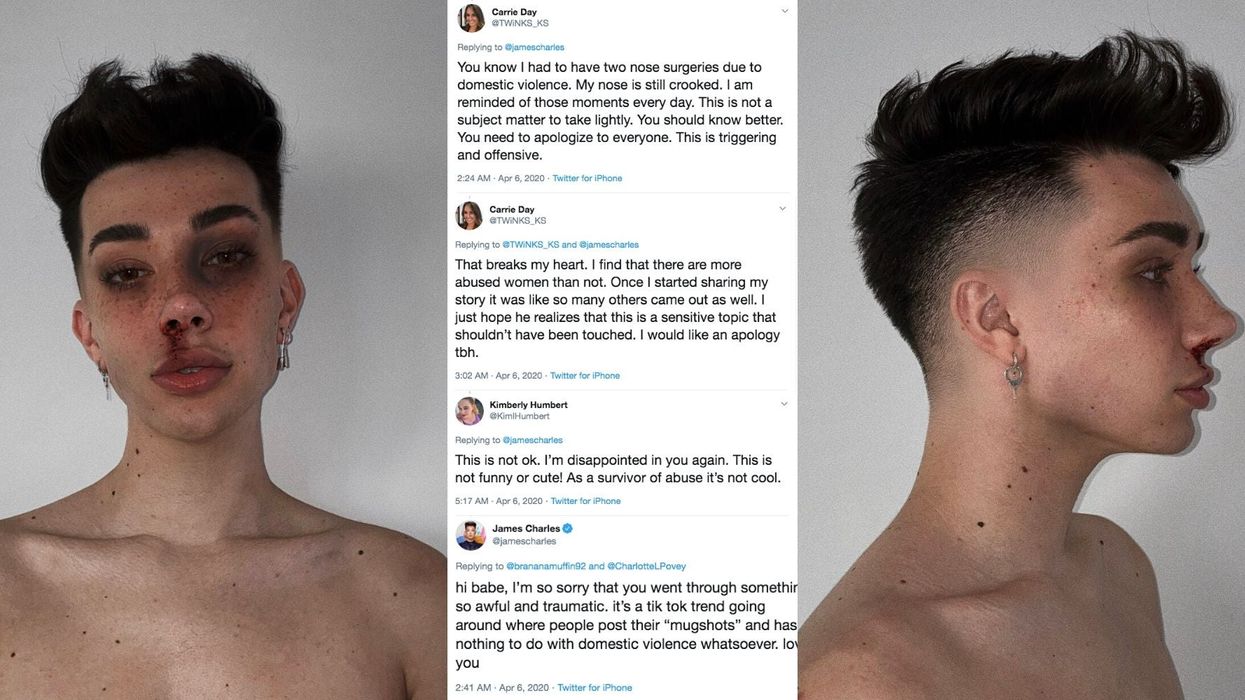 YouTuber James Charles slammed for posting fake 'mugshot' pictures making his face look bruised